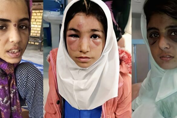 افزایش کودک‌آزاری در ایران به‌عنوان نشانه‌ای از ضعف در نظام حمایت از حقوق کودک، بازتابی از بحران‌های اجتماعی و نابرابری‌های جنسیتی است که به شکل‌های مختلف جسمی، روانی و جنسی نمود پیدا می‌کند و امنیت کودکان، به‌ویژه دختران، را تهدید می‌کند.
